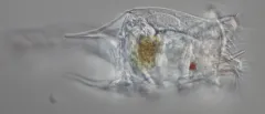 Brachionus quadridentatus thumbnail 2