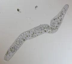 Spirostomum ambiguum thumbnail 1