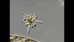 Staurastrum anatinum thumbnail 1