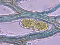 Lindberg's Sphagnum thumbnail 2