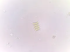 Tetradesmus lagerheimii thumbnail 3