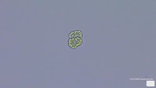 Woronichinia compacta