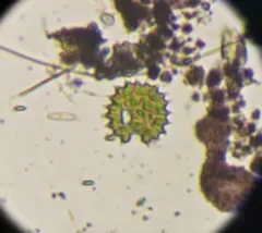 Pseudopediastrum boryanum thumbnail 3