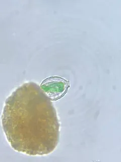 Paulinella chromatophora thumbnail 2