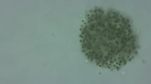 Microcystis smithii
