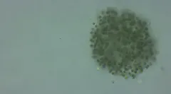 Microcystis smithii thumbnail 1