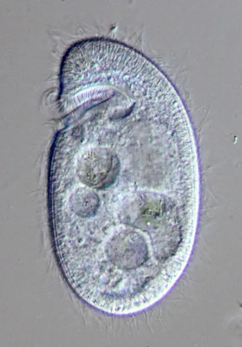 Plagiopyla nasuta