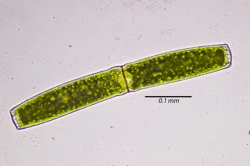 Pleurotaenium ehrenbergii