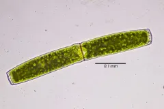 Pleurotaenium ehrenbergii thumbnail 1