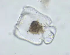 Euastrum crassum thumbnail 4