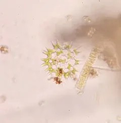 Pediastrum duplex thumbnail 4