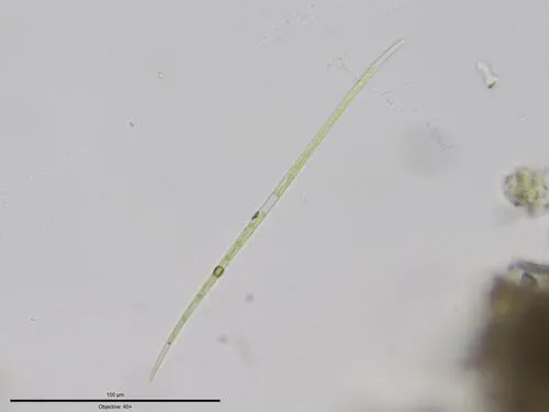 Closterium limneticum