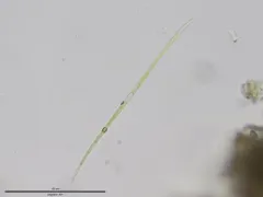 Closterium limneticum thumbnail 1
