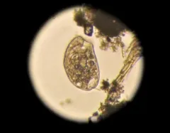 Climacostomum virens thumbnail 2