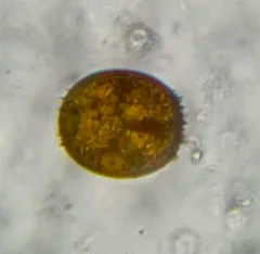 Trachelomonas armata thumbnail 2