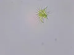 Ankistrodesmus fusiformis thumbnail 1