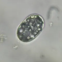 Achromatium oxaliferum thumbnail 3