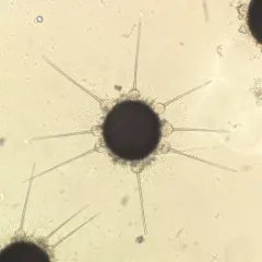 Phyllactinia corni thumbnail 1