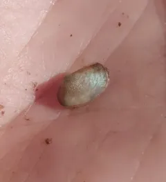 Sandy lyonsia thumbnail 1