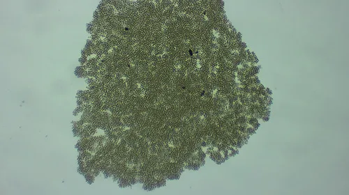 Microcystis natans
