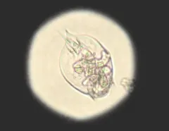 Lepadella acuminata thumbnail 2