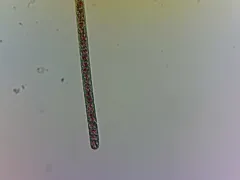 Planktothrix rubescens thumbnail 2