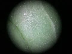 Erysiphe peckii thumbnail 2