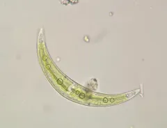 Closterium moniliferum thumbnail 2