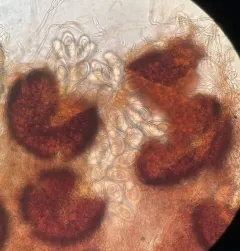 Golovinomyces asterum thumbnail 2
