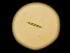 Chlorogonium elongatum thumbnail 1