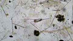 Kellicottia longispina thumbnail 4