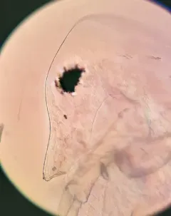 Daphnia dubia thumbnail 1