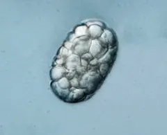 Achromatium oxaliferum thumbnail 2