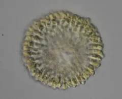Uroglena volvox thumbnail 1