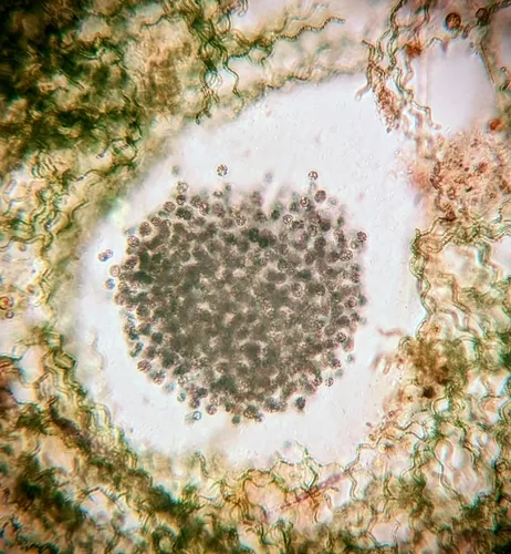 Microcystis aeruginosa