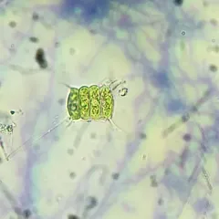Desmodesmus communis thumbnail 2