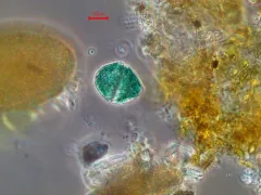 Nusuttodinium aeruginosum thumbnail 2