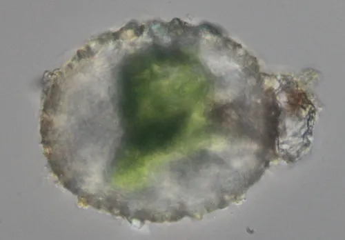 Cucurbitella mespiliformis