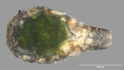 Difflugia pyriformis