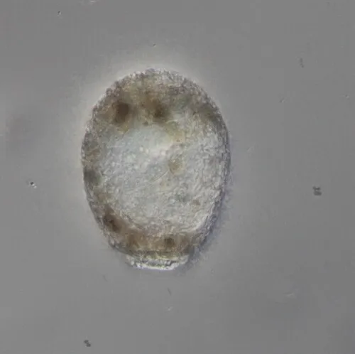 Difflugia limnetica