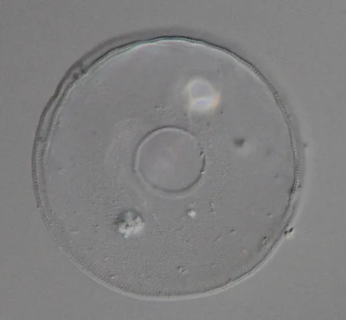 Arcella vulgaris