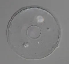 Arcella vulgaris thumbnail 1