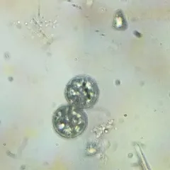Achromatium oxaliferum thumbnail 4
