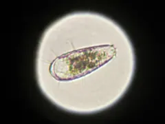 Euglypha filifera thumbnail 2