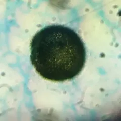 Woronichinia naegeliana thumbnail 4