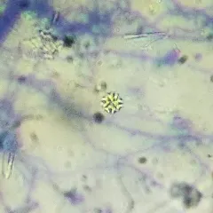 Stauridium tetras thumbnail 3