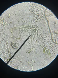 mosquito fern cyanobacterium thumbnail 2