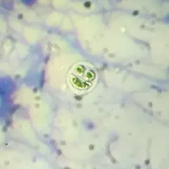 Nephrocytium lunatum thumbnail 1