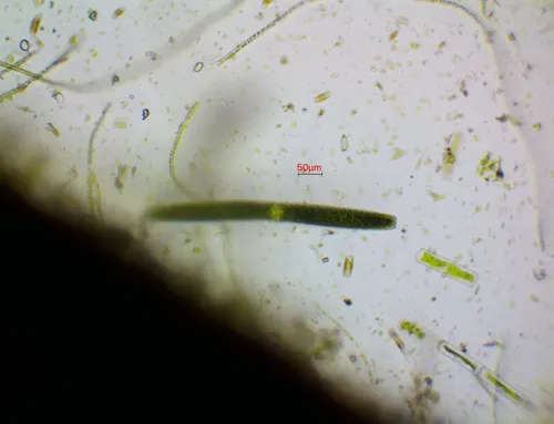 Pleurotaenium trabecula