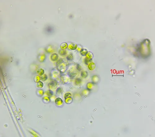 Mucidosphaerium pulchellum